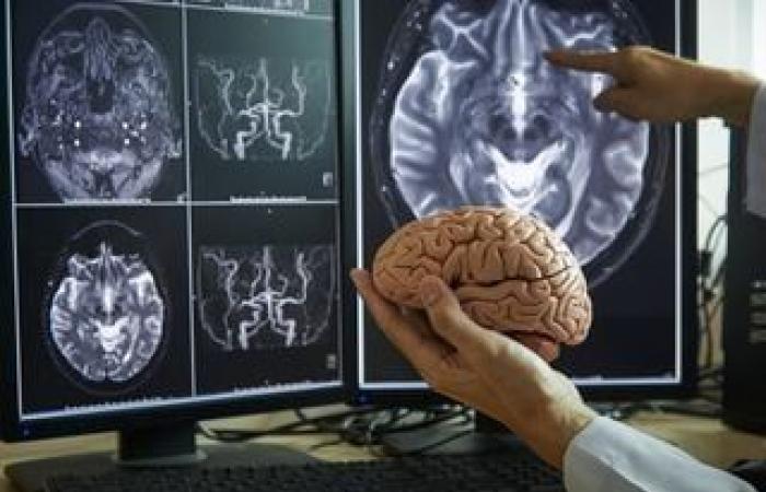 Regimes rich in fat and sugar are linked to poor memory in young adults
